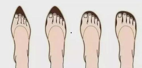 女明星拇外翻,揭秘女明星拇外翻的美丽背后